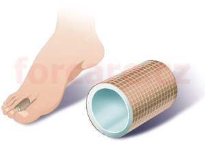ZANNI Gelový tubulární návlek na prst s textilem, střihem upravitelný 10 cm S